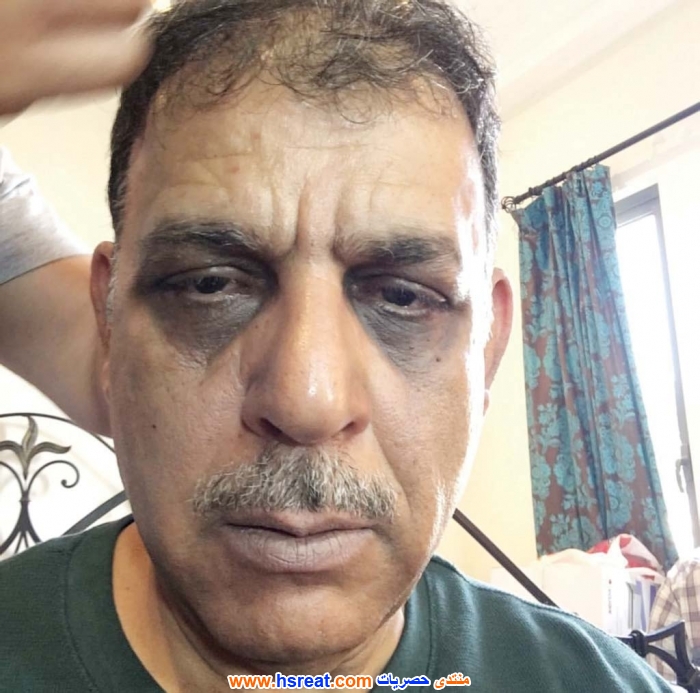 أنور-أحمد-5.jpg